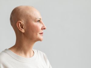 Cáncer del sistema nervioso central