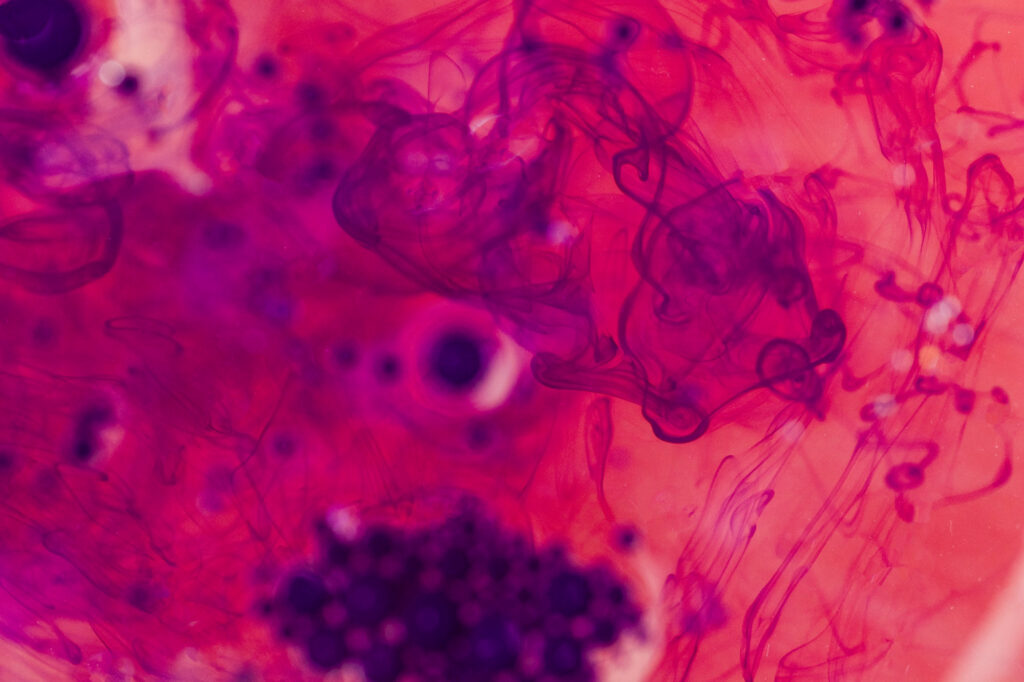 Enfermedad Tromboembólica Venosa en el paciente con cáncer